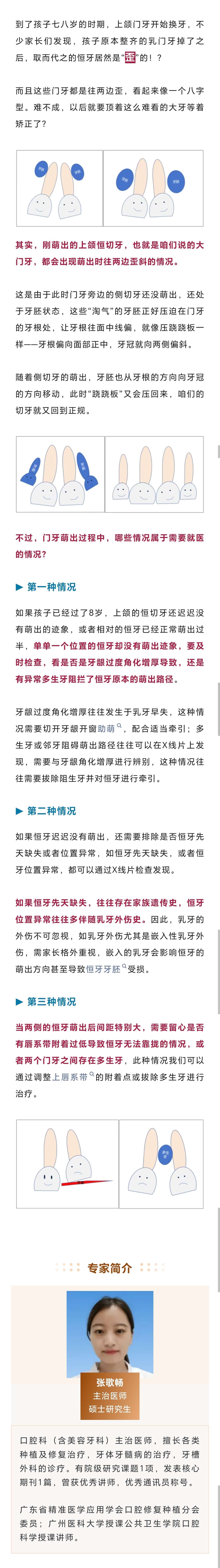 畅想畅言｜刚长的门牙为什么总是往两边歪？.jpg